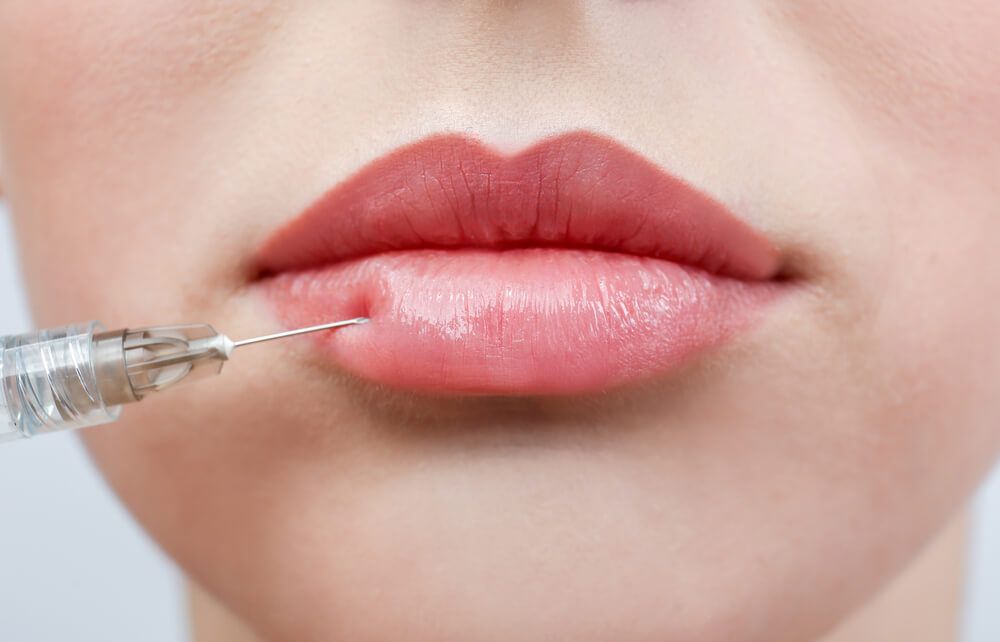 Ästhetische Behandlung Lippen