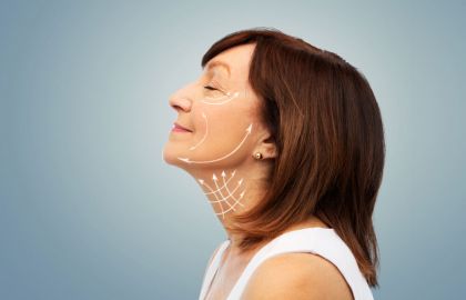 Orta Yüz Kaldırma (Midface Lifting)